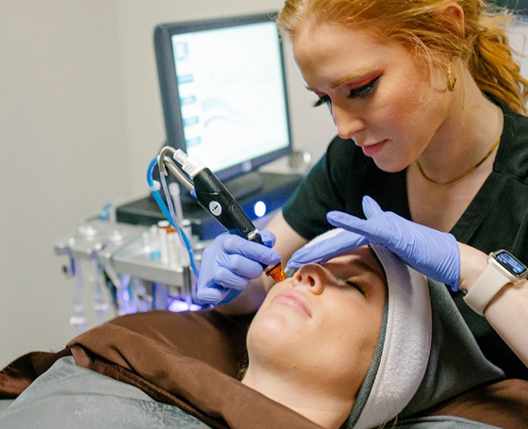 Tixel and Microneedling Treatment